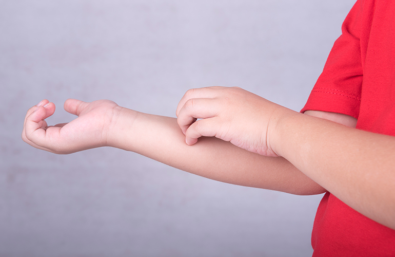 Gypsy Moth Rash- What You Need to Know