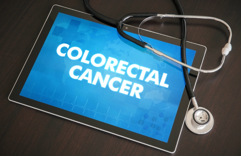 Is it Time for Your Colon Cancer Screening?